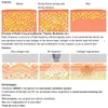 Rimozione dimagrante radiofrequenza bipolare cavitazione ultrasonica macchina per cellulite vuoto perdita di peso attrezzatura di bellezza