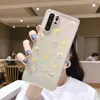 Real Dry Flowers Phone Cases For Xiaomi Redmi Note 10 9S 9 8 Pro 7 6 K30 Pro Mi 11T Pro 11 Lite Note 10 9 SE Glitter Clear Cover