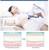 2023 Carboxytherapy No Needle Mesotherapy RF Skin Whitening Beauty Machine