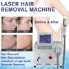 máquina de remoção de cabelo laser em casa