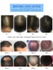 ヘアケアスタイリングツールレーザー成長ヘア成長装置の髪の再生療法