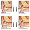 EPACK IN EAR RENGING Endoskop Spoon Mini Camera Ear Picker Ear Wax Removal Visual Mouth Nose Otoscope Support Android PC6168130