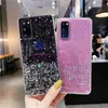 Drop Glue Glitter Star Bing Epoxy TPU Back Cover Cases For iPhone 13 Pro Max Samsung S21 Ultra S20 FE S10 S9 Note 10 20 A03S A21S A32 A52 5G A22 A31 A51 F62 A7 A8 A42 A02 A10