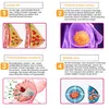 5 in 1 진공 RF 마사지 요법 확대 펌프 리프팅 유방 증강기 마사지 흉상 컵 바디 성형기