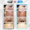 11in1 الجلد الجلدي في microdermabrasion آلة الهيدريدريدراترمودرية الحيوية رفع معدات الجمال RF