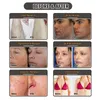 Mest populära OPT IPL Laser Beauty Equipment New Style IPL Machine AFT Hårborttagning Elight Skin Rejuvenation