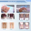 Portable Slimmiing Machine EMS Body shaping Slim Muscle Stimulator Machines Emslim Handle with RF Beauty System