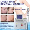 máquina de remoção de cabelo laser portátil