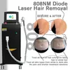 Unik design hemanvändning 808nm mini hårborttagning hand håll laser maskin epil laser hår ta bort snabb frakt