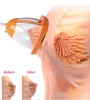 5 in 1 Cavitation RF 슬리밍 유방 마사지 적외선 치료 진공 유방 및 향상 엉덩이 리프트 기계