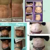 지방 연소 cryolipolysis 360도 신체 슬리밍 진공 체중 감소 cryo machine 5 냉각 손잡이