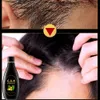 Hoofdhuid haarfollikel shampoo antibacteri￫le antiitching mijten oliebestrijding psoriasis en hoofdhuid reinigende shampoo huidverzorging product