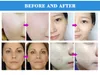 3 in 1 Vacuum Diamond Microdermabrasion Dermabrasion Skin Peeling Beauty Machine BWrinkles Blackhead Removal Device