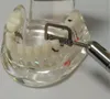 Interproximal Sıyırma Pistonlu Ortodontik Dental 4: 1/1: 1 El Aleti Seti