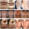 Hårborttagning IPL Laser Beauty Machine ELIGHT RF ACNE REBLEMPT OPT Hud Rejuvenation Portable Epilator Machines