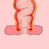 Massage zachte siliconen buttplug anale seksspeelgoed prostaat massager mannelijke penis dildo insert ontwerp pluggen holle en tunnels voor vrouwen mannen homo