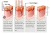콜라겐 치료 기계 / 붉은 빛 안티 에이징 / 뷰티 스킨 케어 장비 PDT 침대 적외선 붉은 조명 치료 뷰티 살롱을위한 침대