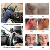 Grande professione permanente laser pico picosecondo tatuaggio macchina per rimozione laser pico seconda pigmentazione nd yag 755nm lazer lentempedle rimozione attrezzatura