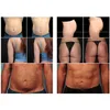 Bantmaskin icke-kirurgisk förlust fett reduktion kropp skulptur cellulitbehandling djup uppvärmning rf radiofrekvens fettborttagning hud föryngring synd