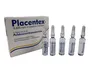 아름다움 항목 Placepentexs 5.625 mg / 3 ml x 5 vials pdrn nctf