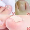 100pcs/zestaw Korekcję paznokci naklejki wrastające korytale paznokci Patche Paronychia Leczenie Odzyskiwanie korektor narzędzi pedicure