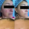 2021 Hydra Microdermoabrasão Aqua Peeling 9 em 1 Oxigênio Jet Hidro Facial DermaaBrasion Pele Peeling Hydra Máquina Facial