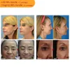 2022 NEW 3D 4D 5D HIFU 7D 9D SMAS膣締め他の美容装備facial Ice Ice Mini Cartridge Facelift Ultrasonic Hifu Slimming Machine