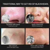 Chargeur USB Aspirateur Blackhead Remover Blackhead Pimple Removal Aspiration Cleaner Facial T Zone Nez Pore Deep Cleansing Care Tool 220514
