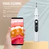 Visual Ultrasonic Irrigator Dental Scaler Calculus Oral Tartar Remover Tooth Stain Cleaner LED Tänkar Verkningsverktyg 220513