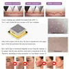 NEW Tixel RF wrinkle skin regeneration machine facial body scars removal machine