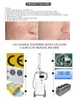 2022 RF tube fractional carbon dioxide laser machine/CO2 laser/CO2 fractional vagina tightening beauty items