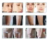 Ultraslim Vacuum Slimming Machine RF Facial Machine Dispositivo di serraggio e sollevamento della pelle