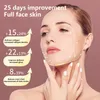 Microcurrent V Face Shape Face Lifting EMS Slimming Massager Double Chin Remover LED Light Lift Device 220426