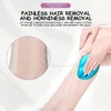 Fiziksel epiloving Cam Ağrısız Saç Çıkma Silgi Güvenli Epilatör Kolay Temizleme Yeniden Kullanılabilir Taşınabilir Güzellik Cilt Bakım Aracı