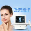 금 Microneedle 무선 주파수 RF 기계 일회용 핀 팁 Nano 용 액세서리 부품