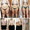 أعلى مستوى لآلة التخسيس EMS فقدان الوزن معدة مثير للنساء تحلل الجسم تدليك السيلوليت تقليل الدهون لتجميد الدهون لاستخدام السبا