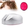 Till salu Diode Laser Cap Hair REGROWTH Anti Hair Loss Forum Treatment Hat Reddit Sheedding Machine inte gran LED -glödlampor Pris