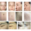 الجمال عناصر ND YAG CO2 4D FOTONA ERBIUM Fractional Laser Stretch Marks Removal Recial Care Beauty Equipment 2940nm 1064nm