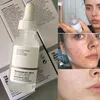 Cilt Bakımı Serumu 30ml Asit Peeling Çözelti Büfe Eksfoliye Akne Yüz Onarım Özü Tedavisi 1FL.Oz Yüksek Kaliteli Hızlı Teslimat