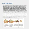 Ayakta EMS Vücut Konturlama Yapın kas selülitinin çıkarılması Yağ Burn Criyolipoliz Makinesi Satılık