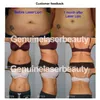 Tragbare Laser-Lipo-Laser-Lipo-Fettschmelzmaschinen, Fettabsaugung, Gewichtsverlust, Dioden-Lipolyse, Cellulite-Reduktionsmaschinen, 14 Pads