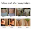 80K Ultrasonic Cellulite Removal Fat Burner Machine Vacuum Cavitation Slimming Machine