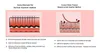 10 teile/los MYM Elektrische Derma Stempel Dermapen Micro Nadel Roller Gesichts Schönheit Ausrüstung, Micro Nadel Therapie System Dermapen Medical.