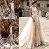 Vestido De Noiva 신부 가운 샴페인 빈티지 섹시한 레이스 분리형 스커트 웨딩 드레스 2018 분리형 웨딩 드레스 기차