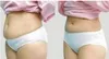 салон клиники сп ВЧ ультразвук UltraShape liposonic тело тонкие абы формирователь машина