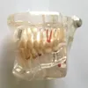 VENDITE CALDE Igiene orale denti in plastica di dimensioni naturali modello di denti rimovibili