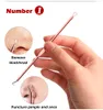 4 dingen. Rose Gold Needles Acne Pimple Needle Blackhead Remover Acne Behandeling Zwart Masker Extractor