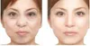 스파 바늘 무료 mesotherapy 미용 기계 / 바늘 무료 mesotherapy 얼굴 리프트 장치 판매