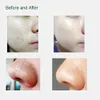 Comedo Sug Diamond Peeling laddningsbart vakuum Blackhead Remover Skinvård Skönhetsanordning Deep Facial Pore Cleansing Tool2381004