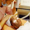 300 ml mjuk laserkolkräm gel för nd yag laser hudföryngring behandling aktiv kol cream8839364